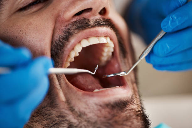 Best Emergency Dental Care for Broken or Chipped Teeth in Colonial Beach, VA