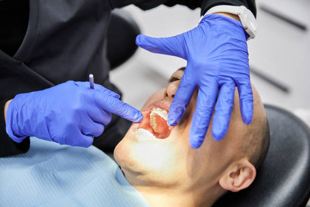 Best Emergency Treatment for Dental Infections or Abscesses in Colonial Beach, VA