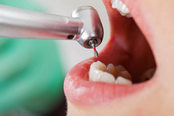 Best Emergency Dental Care for Broken or Chipped Teeth in Colonial Beach, VA